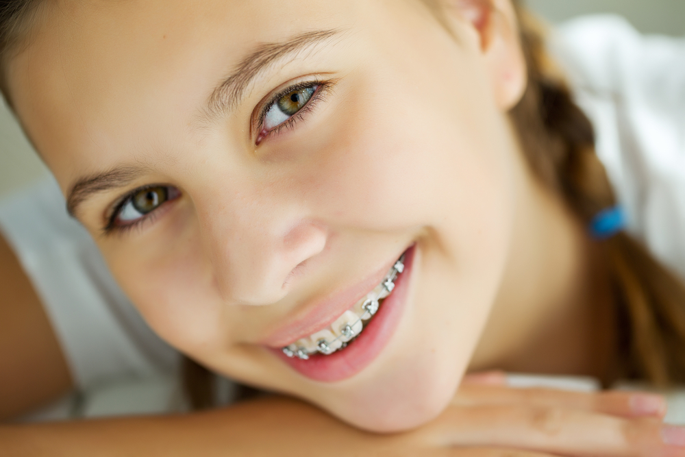 Accelerated Orthodontics Virginia Beach Va Norfolk Accelerated